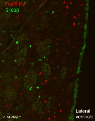 Immunohistochemistry (Frozen sections) - Anti-Fos B antibody [83B1138] (AB11959), expandable thumbnail