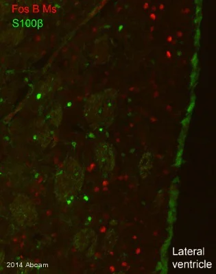 Immunohistochemistry (Frozen sections) - Anti-Fos B antibody [83B1138] (AB11959)