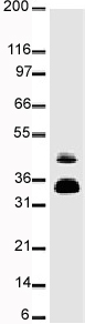 Western blot - Anti-Fos B antibody [83B1138] (AB11959), expandable thumbnail