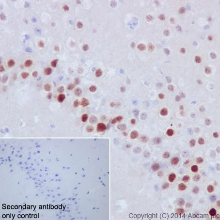 Immunohistochemistry (Formalin/PFA-fixed paraffin-embedded sections) - Anti-Fos B antibody [EPR15905] (AB184938)