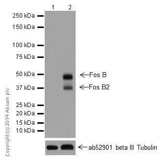 Western blot - Anti-Fos B antibody [EPR15905] (AB184938)