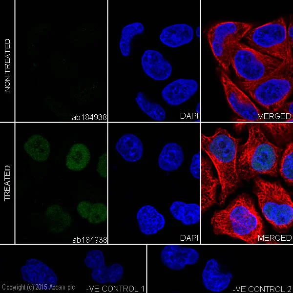 Immunocytochemistry/ Immunofluorescence - Anti-Fos B antibody [EPR15905] - BSA and Azide free (AB240288)
