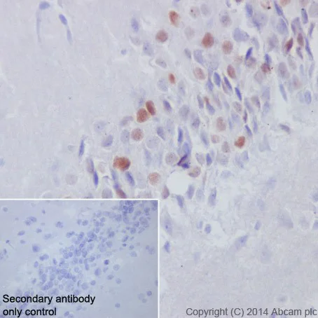 Immunohistochemistry (Formalin/PFA-fixed paraffin-embedded sections) - Anti-Fos B antibody [EPR15905] - BSA and Azide free (AB240288)