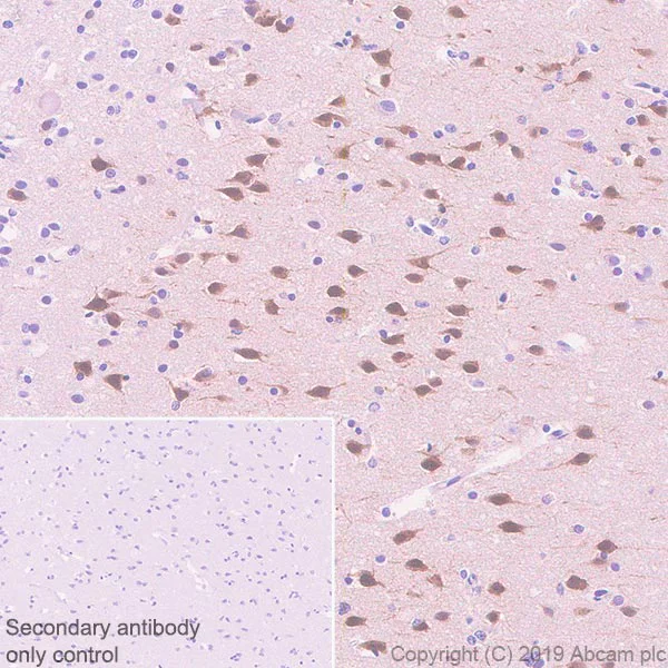 Immunohistochemistry (Formalin/PFA-fixed paraffin-embedded sections) - Anti-Fos B antibody [EPR23489-90] (AB252237)
