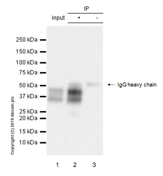 Immunoprecipitation - Anti-Fos B antibody [EPR23489-90] (AB252237)