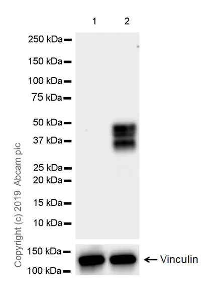 Western blot - Anti-Fos B antibody [EPR23489-90] (AB252237)