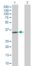 Western blot - Fos B overexpression 293T lysate (whole cell) (AB94279)