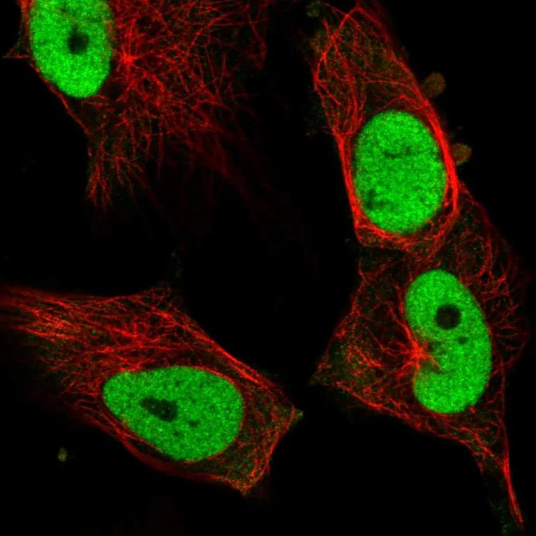 Immunocytochemistry/ Immunofluorescence - Anti-FOSL1 Antibody (AB327266)