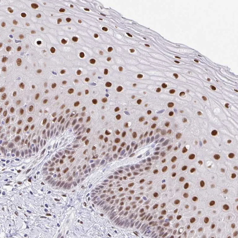 Immunohistochemistry (Formalin/PFA-fixed paraffin-embedded sections) - Anti-FOSL2 Antibody (AB327251)