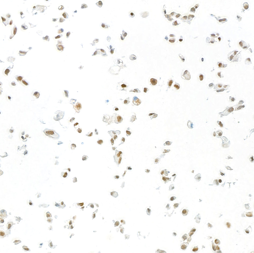 Immunocytochemistry - Anti-FOX2/RBM9 antibody [BLR215K] - BSA free (ab314068), expandable thumbnail