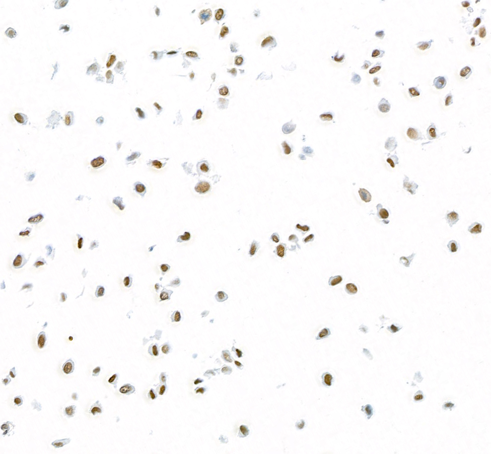 Immunocytochemistry - Anti-FOX2/RBM9 antibody [BLR215K] - BSA free (ab314068), expandable thumbnail