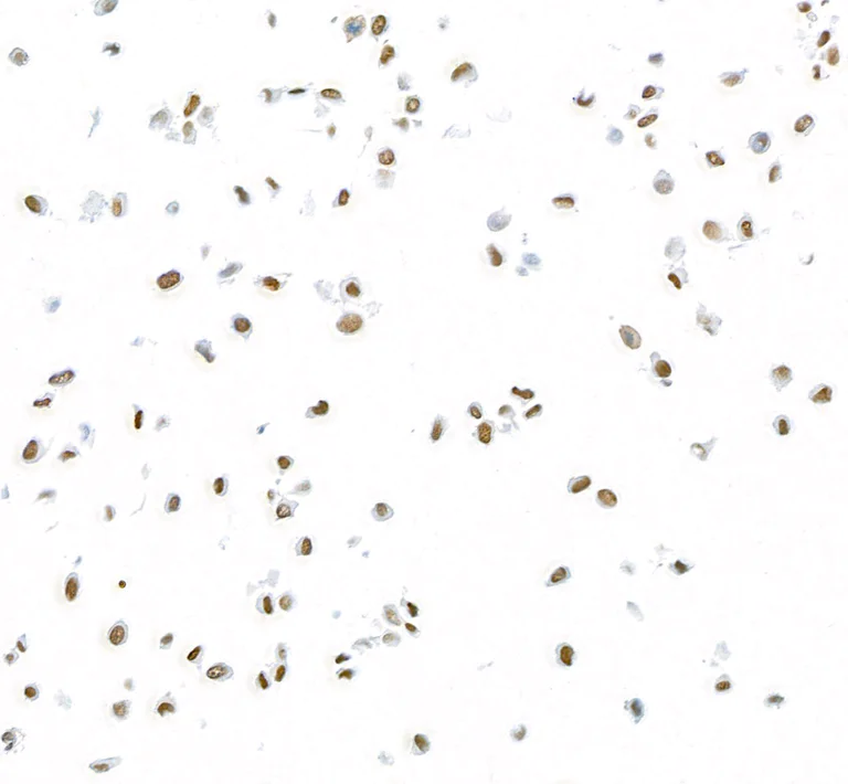 Immunocytochemistry - Anti-FOX2/RBM9 antibody [BLR215K] - BSA free (AB314068)