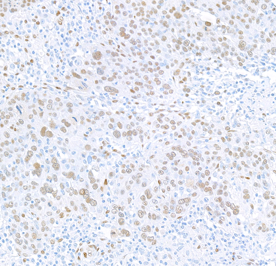 Immunohistochemistry (Formalin/PFA-fixed paraffin-embedded sections) - Anti-FOX2/RBM9 antibody [BLR215K] - BSA free (ab314068), expandable thumbnail