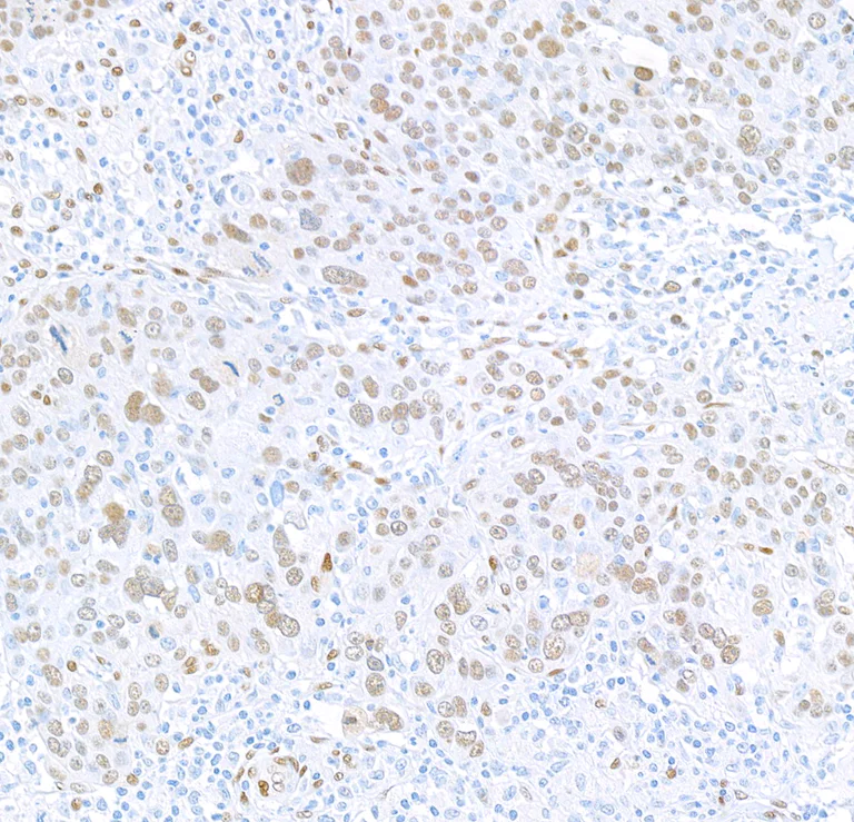 Immunohistochemistry (Formalin/PFA-fixed paraffin-embedded sections) - Anti-FOX2/RBM9 antibody [BLR215K] - BSA free (AB314068)