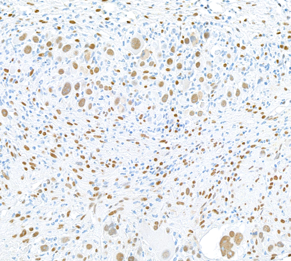 Immunohistochemistry (Formalin/PFA-fixed paraffin-embedded sections) - Anti-FOX2/RBM9 antibody [BLR215K] - BSA free (ab314068), expandable thumbnail