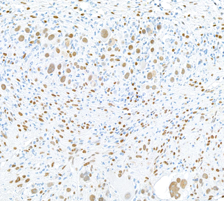 Immunohistochemistry (Formalin/PFA-fixed paraffin-embedded sections) - Anti-FOX2/RBM9 antibody [BLR215K] - BSA free (AB314068)