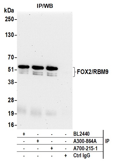 Immunoprecipitation - Anti-FOX2/RBM9 antibody [BLR215K] - BSA free (AB314068), expandable thumbnail