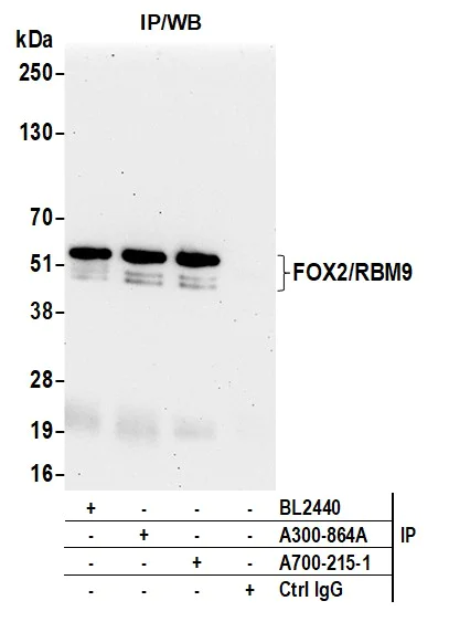 Immunoprecipitation - Anti-FOX2/RBM9 antibody [BLR215K] - BSA free (AB314068)