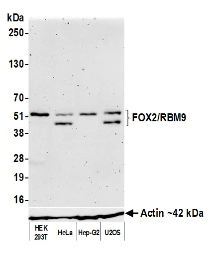 Western blot - Anti-FOX2/RBM9 antibody [BLR215K] - BSA free (AB314068)