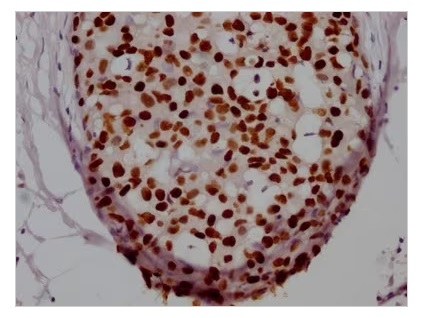 Immunohistochemistry (Formalin/PFA-fixed paraffin-embedded sections) - Anti-FOXA1 antibody [3B2] (AB314012), expandable thumbnail