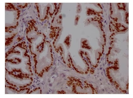 Immunohistochemistry (Formalin/PFA-fixed paraffin-embedded sections) - Anti-FOXA1 antibody [3B2] (AB314012), expandable thumbnail