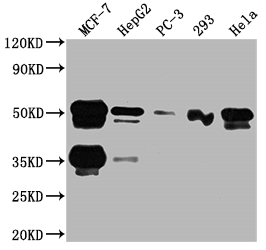 Western blot - Anti-FOXA1 antibody [3B2] (AB314012), expandable thumbnail
