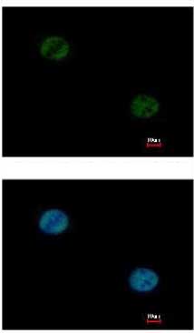 Immunocytochemistry/ Immunofluorescence - Anti-FOXA1 antibody (AB151522), expandable thumbnail