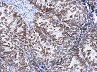 Immunohistochemistry (Formalin/PFA-fixed paraffin-embedded sections) - Anti-FOXA1 antibody (AB151522)