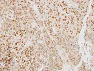 Immunohistochemistry (Formalin/PFA-fixed paraffin-embedded sections) - Anti-FOXA1 antibody (AB151522), expandable thumbnail
