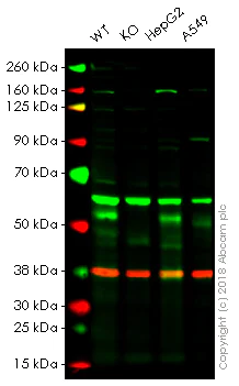 Western blot - Anti-FOXA1 antibody (AB23738)