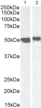 Western blot - Anti-FOXA1 antibody (AB5089)