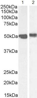 Western blot - Anti-FOXA1 antibody (AB5089)