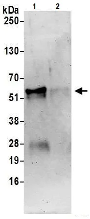 Immunoprecipitation - Anti-FOXA1 antibody - C-terminal (AB226380)