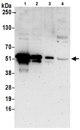 Western blot - Anti-FOXA1 antibody - C-terminal (AB226380)