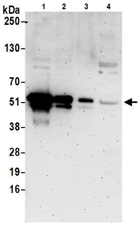 Western blot - Anti-FOXA1 antibody - C-terminal (AB226380)