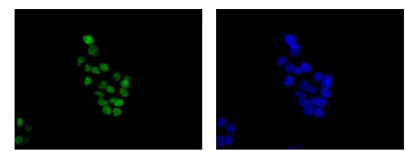 Immunocytochemistry/ Immunofluorescence - Anti-FOXA1 antibody [EPR10881-14] (AB173287)