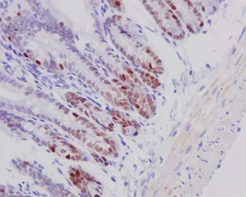Immunohistochemistry (Formalin/PFA-fixed paraffin-embedded sections) - Anti-FOXA1 antibody [EPR10881-14] (AB173287)