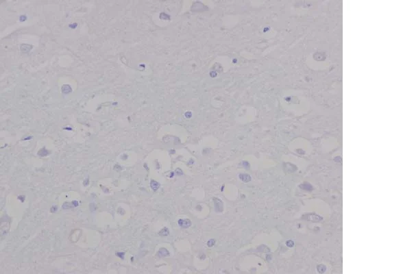 Immunohistochemistry (Formalin/PFA-fixed paraffin-embedded sections) - Anti-FOXA1 antibody [EPR10881-14] - BSA and Azide free (AB249749)