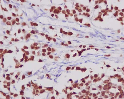 Immunohistochemistry (Formalin/PFA-fixed paraffin-embedded sections) - Anti-FOXA1 antibody [EPR10881-14] - BSA and Azide free (AB249749)