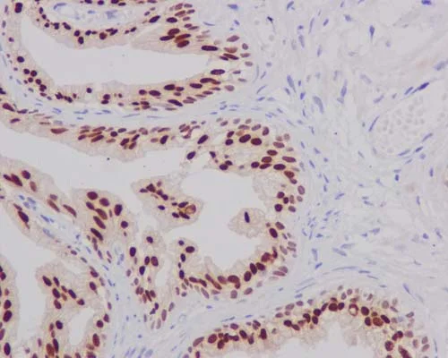 Immunohistochemistry (Formalin/PFA-fixed paraffin-embedded sections) - Anti-FOXA1 antibody [EPR10881-14] - BSA and Azide free (AB249749)
