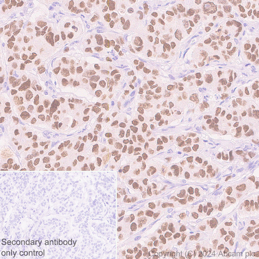 Immunohistochemistry (Formalin/PFA-fixed paraffin-embedded sections) - Anti-FOXA1 antibody [RM1119] (ab317046), expandable thumbnail