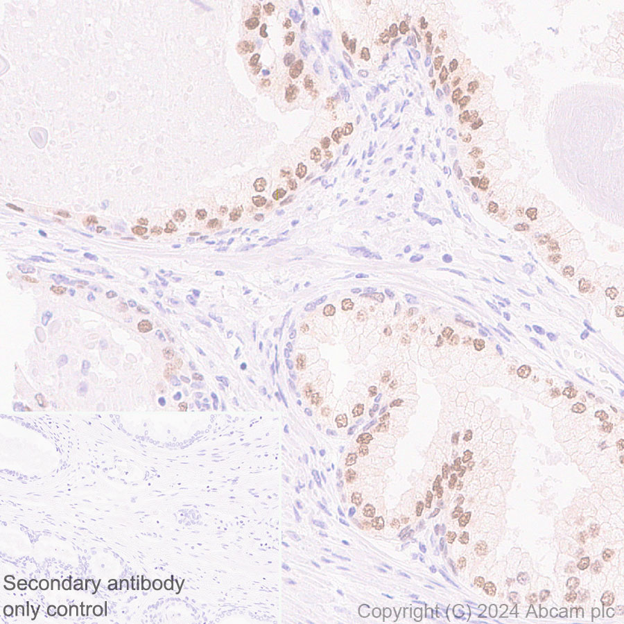 Immunohistochemistry (Formalin/PFA-fixed paraffin-embedded sections) - Anti-FOXA1 antibody [RM1119] (ab317046), expandable thumbnail