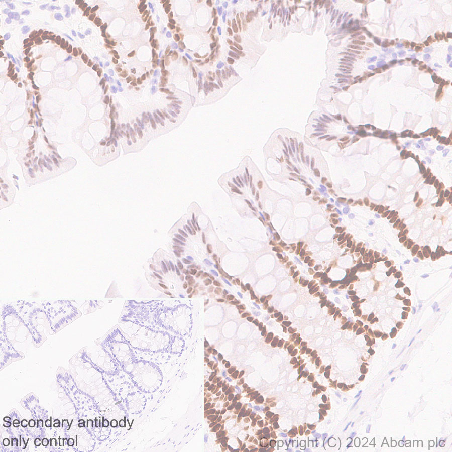 Immunohistochemistry (Formalin/PFA-fixed paraffin-embedded sections) - Anti-FOXA1 antibody [RM1119] (ab317046), expandable thumbnail