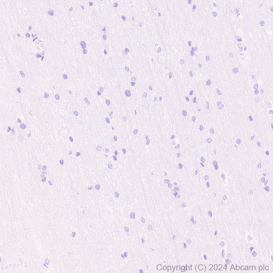 Immunohistochemistry (Formalin/PFA-fixed paraffin-embedded sections) - Anti-FOXA1 antibody [RM1119] (ab317046), expandable thumbnail