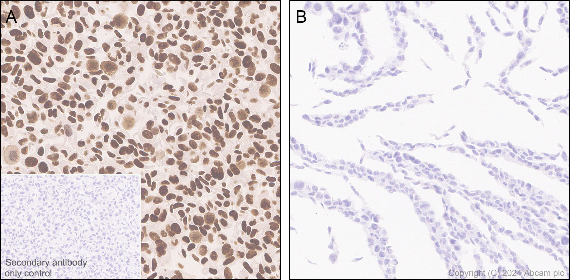 Immunohistochemistry (Formalin/PFA-fixed paraffin-embedded sections) - Anti-FOXA1 antibody [RM1119] (ab317046), expandable thumbnail