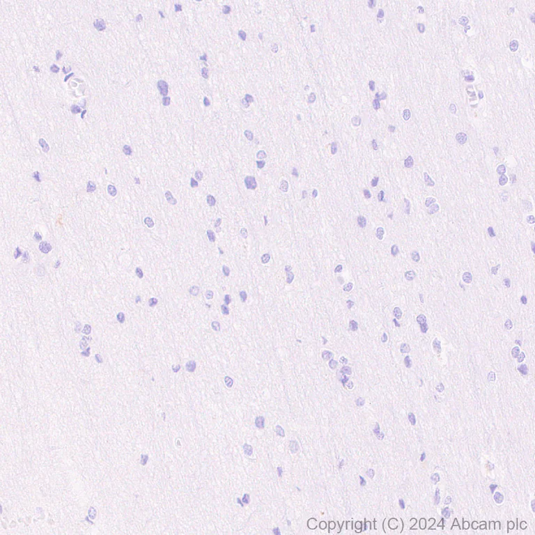 Immunohistochemistry (Formalin/PFA-fixed paraffin-embedded sections) - Anti-FOXA1 antibody [RM1119] - BSA and Azide free (AB317047)