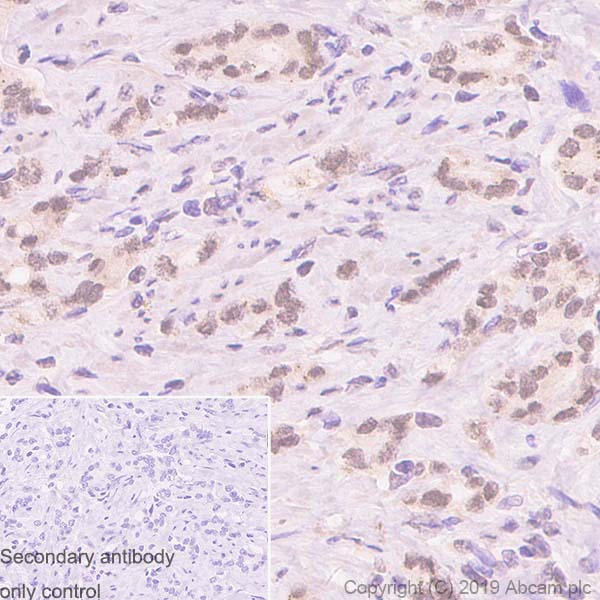 Immunohistochemistry (Formalin/PFA-fixed paraffin-embedded sections) - Anti-FOXA1 antibody [SP88] - BSA and Azide free (AB240935)