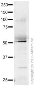 Western blot - Anti-FOXA1 + FOXA2 antibody (AB23738)