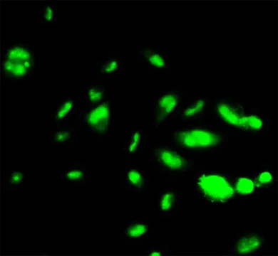 Immunocytochemistry/ Immunofluorescence - Anti-FOXA1 + FOXA2 + FOXA3 antibody [1B1] (AB55178)