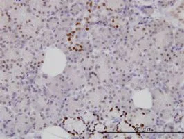 Immunohistochemistry (Formalin/PFA-fixed paraffin-embedded sections) - Anti-FOXA1 + FOXA2 + FOXA3 antibody [1B1] (AB55178)